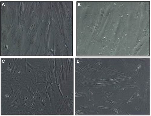 Figure 4 Morphological changes of CRL-2014 exposed to AgNPs and F by phase-contrast microscopy. Cells co-exposed to AgNPs (1.5 μg/ml) and F (1 mM) for 12 hours (C) and 24 hours (D) showed irregular cell shapes and cell shortening compared to AgNPs-treated cells (A) and F-treated cells (B).Note: Original magnification was 20×.Abbreviations: AgNPs, silver nanoparticles; F, fluoride.