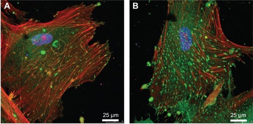 Figure 9 The adhesion of primary human osteoblasts on H-terminated NCD films and O-terminated NCD films.Notes: Primary human osteoblasts cultivated on H-terminated NCD films (A) and on O-terminated NCD films (B) for 7 days. The cells were stained for talin (green; immunofluorescence), actin (red; phalloidin/TRITC), and DNA (blue; DAPI). Similar results have been published.Citation45Abbreviations: NCD, nanocrystalline diamond; TRITC, tetramethylrhodamine; DAPI, 4′,6-diamidino-2-phenylindole.