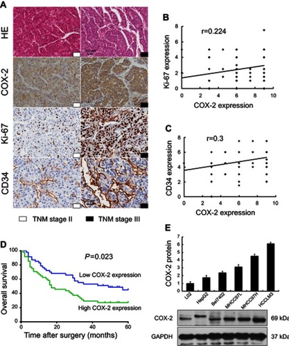 Figure 2 Association of COX-2 expression between clinicopathological features and 5-year overall survival in human HCC, and expression of COX-2 in the normal human liver cell and HCC cell lines. IHC for COX-2, Ki-67, and CD34 in HCC patients with TNM stage II and III (A) have shown that COX-2 expression was significant positively correlated with Ki-67 (B, r=0.224, P=0.029, n =95) and CD34 expression (C, r=0.3, P=0.003, n=95) in HCC tissues. The 5-year overall survival was better in patients with low COX-2 expression when compared with those with high COX-2 expression (D, P=0.023, n=95). The expression levels of COX-2 in normal human liver cell and HCC cell lines increased along with the metastatic capacity by Western blot (E).