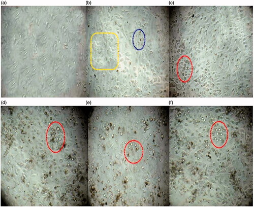 Figure 11. Effect of the IH-AgNPs on the cell viability of PC3 cells (a) Normal control (Without any treatment), (b) PC3 cells treated with 10 µg/mL of IH-AgNPs, (c) PC3 cells treated with 50 µg/mL of IH-AgNPs, (d) PC3 cells treated with 100 µg/mL of IH-AgNPs, (e) PC3 cells treated with 150 µg/mL of IH-AgNPs and (f) PC3 cells treated with 200 µg/mL of IH-AgNPs. Yellow box indicates cells undergo morphological changes, Green round circle indicates the initial apoptotic cells, Red round circles indicates dead cells or nonviable cells. Increase in the concentration of IH-AgNPs increases the cytotoxic activity (or increase in the number of non-viable cells).