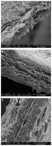 Figure 1 SEM images of multilayer nanofibrous structures in which the middle crosslinked PVA layer (0.8 g/m2) containing 10 wt% gentamicin is covered with PUR layers of 1.5 (A), 4.4 (B), or 14.7 g/m2 (C) basis weight.Abbreviations: PUR, polyurethane; PVA, polyvinyl alcohol; SEM, scanning electron microscopy.