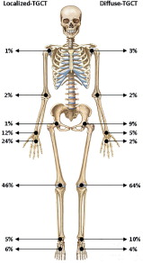 Figure 5. Skeleton, showing affected TGCT localization (fingers and toes excluded). 3% in localized type and 1% in diffuse type is classified as “other”.