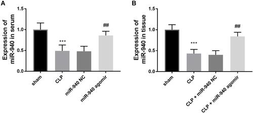 Figure 2 (A and B) Injection of miR-940 agomir reversed the declined expression of miR-940 in serum and tissues from CLP-damaged rats. ***P < 0.001, compared with the sham group; ##P < 0.01, compared with the CLP group.