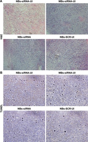Figure 10 H&E and TUNEL assays of U87 glioma sections of tumor-bearing mice in the four different groups. (A) H&E staining: Nuclei were stained blue and cytoplasm were stained red. (B) TUNEL analyses: brown apoptotic cells were stained brown and that of normal glioma cells were blue.