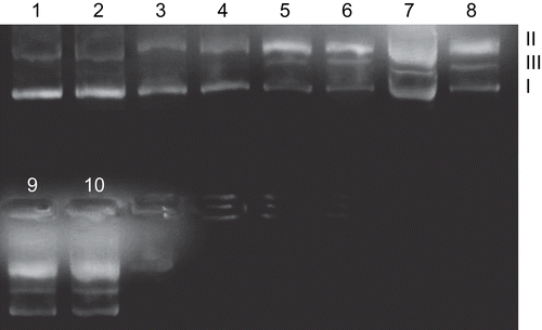 Figure 7.  Photogenic view of cleavage of pUC19 DNA (300 µg/mL) with series of copper(II) complexes (200 µM) using 1% agarose gel containing 0.5 µg/mL ethidium bromide. All reactions were incubated in TE buffer (pH 8) in a final volume of 15 µL, for 24 h. at 37°C. Lane 1, DNA control; Lane 2, CuCl2·2H2O; Lane 3, Sparfloxacin; Lane 4, Pefloxacin; Lane 5, [Cu(SPF)(A1)Cl].5H2O; Lane 6, [Cu(SPF)(A2)Cl].5H2O; Lane 7, [Cu(SPF)(A3)Cl].5H2O; Lane 8, [Cu(PFL)(A1)Cl].5H2O; Lane 9, [Cu(PFL)(A2)Cl].5H2O; Lane 10, [Cu(PFL)(A3)Cl].5H2O.