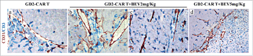 Figure 3. Analysis of vascular network and T lymphocyte distribution in tumors developed in Scid/Beige mice after orthotopic engrafment of HTLA-230 NB cells and treated with GD2-CAR T cells alone or in combination with BEV. CD31 (red) and CD3 (blue) double immunostaining of tumors from mice treated with GD2-CAR T cells (a) as single agent or in combination with BEV at 2 mg/Kg (b,c) and 5 mg/Kg (d). (a, b, c: X400; d: X200).