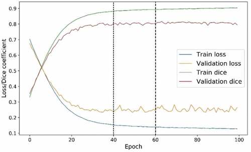 Figure 6. Process of training shape attention Pivot-Net.