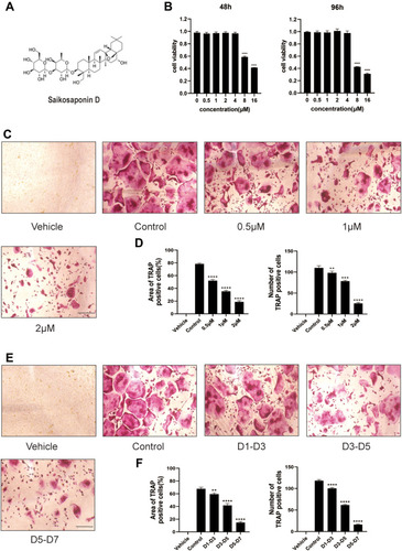 Figure 1 Saikosaponin D attenuated the formation of osteoclasts induced by RANKL. (A) Chemical structure of SSD. (B) Cell viability of BMMs (bone marrow-derived macrophages) was evaluated by CCK-8 at 48, 96h (OD 450nm). (C) The role of SSD in osteoclast formation in a dose-dependent manner. BMMs stimulated by RANKL (50ng/mL) were treated with or without various concentrations of SSD for 7 days. After fixing, the cells subjected to TRAP staining. (D) The number and area of TRAP-positive multinucleated cells (≥3 nuclei). (E) The effect of SSD on osteoclast formation in a time-dependent manner. BMMs which were stimulated by 50ng/mL RANKL and treated with 2μM SSD from day 1 to day 3, from day 3 to day 5, or from day 5 to day 7 were fixed with 4% PFA and subjected to TRAP staining. (F) The number and area of TRAP-positive multinucleated cells (≥3 nuclei). Original magnification, ×100. Scale bar, 200 μm. Mean ± SD is used to describe the data. Above experiments were conducted independently at least 3 times. ****P <0.0001, ***P<0.001, **P <0.01.