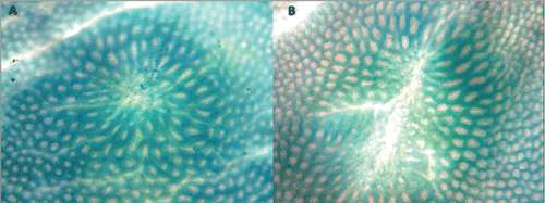 Figure 3. Two examples of heterogeneous (or ill-defined) aberrant crypt focus (ACF) as observed on the colonic mucosal surface following formalin fixation and staining with Methylene Blue in Study 3. Again, a faint outline of the openings of small crypts can be seen at the center of the ACF. We suggest that these changes follow the loss of clusters of crypts and are an early response to the loss of adjacent crypts (The mucosal fields are 1.7 × 0.8 mm.).
