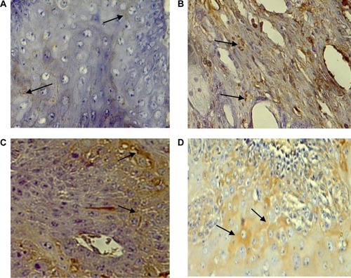 Figure 6 PTEN expression in (A) untreated control, (B) free Dox + free ETP, (C) DPPC-Lip-(Dox + ETP), and (D) CML-Lip-(Dox + ETP)-treated fibrosarcoma-bearing mice.Note: The arrows indicate expression of tumor suppressor gene PTEN.Abbreviations: CML-Lip, camel milk phospholipids liposomes; Dox, doxorubicin; DPPC-Lip, 1,2 dipalmitoyl-sn-glycero-3-phosphatidylcholine liposomes; ETP, etoposide.