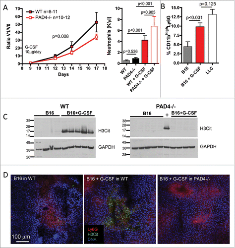 Figure 4. G-CSF treatment induces intratumoral accumulation of NETing neutrophils and promotes B16 tumor growth in WT but not PAD4−/− mice. B16F10 cells were injected in 11 WT and 12 PAD4−/− mice and tumors were allowed to grow. At day 9 post-implantation, when tumors reached 30–50 mm3, daily G-CSF treatment was initiated and tumor growth was monitored. Tumor growth was evaluated until day 17 post-implantation, unless mice were moribund or tumors necrotic and mice were sacrificed. (A) G-CSF treatment of B16 tumor-bearing mice increases tumor growth in WT mice compared to PAD4−/− mice. As the initial volume of the tumors at the beginning of the treatment varies, data are presented as the ratio of the tumor volume at the indicated day (V1) compared to the volume at the initiation of G-CSF treatment (V0). The curves are compared by a non-linear regression analysis (p = 0.008).  Neutrophil counts were increased by G-CSF treatment but no significant difference in the number of circulating neutrophils was observed between both genotypes (n = 9–10). (B) FACS analysis of the 17-d digested tumors from WT mice showed an increased percentage of CD11bhigh neutrophils in the B16 tumors when the tumor-bearing WT mice were treated with G-CSF. This percentage was similar to that seen in LLC tumors from untreated mice (n = 5–6). (C) Western blot showed increased H3Cit in 17-d tumor lysate of B16 tumors from WT mice treated with G-CSF than from untreated mice (left) whereas this was not observed in PAD4−/− mice (right). (D) Confocal microscopy confirmed the presence of higher amounts of H3Cit and NETs in the B16 tumors from WT mice treated with G-CSF that was absent in B16 tumors from PAD4−/− mice similarly treated.