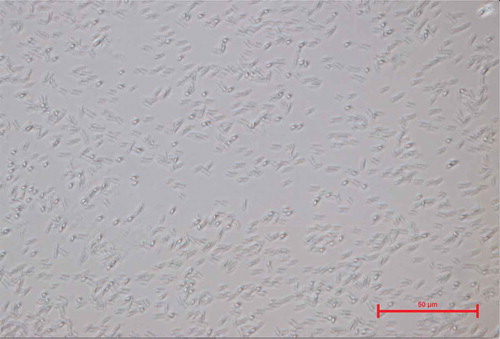 Figure 2. Images of the microbial strain isolated from CSW, obtained with a scanning electron microscopy (SEM).Figura 2. Imágenes de la cepa microbiana aislada de CSW, obtenidas usando un microscopio electrónico de barrido (SEM).