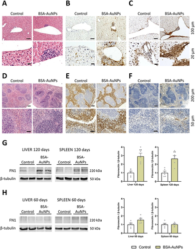 Figure 4 Hematoxylin-eosin staining of liver tissue showed increased infiltration of mononuclear cells (A), partial positivity for F4/80 (B), and enhanced fibronectin deposition (C). Hematoxylin-eosin staining, as well as F4/80 staining of spleen tissue showed any structural disturbances (D and E), but fibronectin detection revealed higher fibronectin content in spleens exposed to BSA-AuNPs for 120 days (F). Differences in fibronectin were also detect between treated and non-treated groups after 120 days by Western blot (G), which was not yet observed at 60 days (H). Data from Western blot represent the mean ± SEM of five independent experiments. Statistical significance among groups: P < 0.01 (**). Magnification (A–C) upper panel 100x, bar 100 µm, lower panel 400x, bar 20 µm. Magnification (D–F) upper panel 40x, bar 200 µm, lower panel 200x, bar 50 µm.