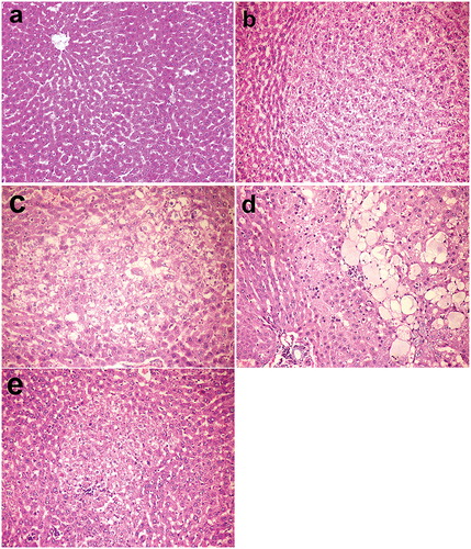 Figure 1. Livers, rats (38th week). (a) Normal hepatic structure in group I (control group). (b) Hepatocellular adenoma in group V injected with DENA. (c) Altered hepatocellular focus with decreased cellular density in group VI injected with DENA and treated with camel milk. (d) Hepatocellular adenoma with spongiosis hepatis in group VII injected with DENA and treated with cisplatin. (e) Mononuclear inflammatory cells invading the periphery of altered hepatocellular focus and single cell necrosis in group VI injected with DENA and treated with camel milk and cisplatin. Haematoxylin and eosin stain 200×.