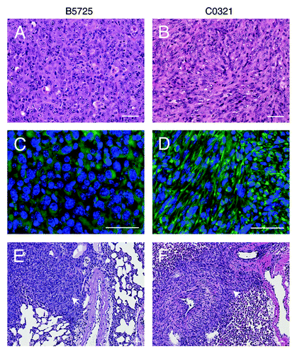 Figure 2. Authotopic isograft of B5725 and C0321 cell lines in FVB mice. (A and B) Representative H&E staining of mammary tumors developed from injection of B5725 or C0321 cell line (1 × 105 cells/mouse) in the mammary fat pad of FVB mice. (C and D) Anti-vimentin immunofluorescence staining of the mammary tumor sections. (E and F) Representative H&E staining of metastatic lesions (white arrows) in the lungs after injection of B5725 or C0321 cell line into the mammary fat pad. Scale bars: 50 μm.