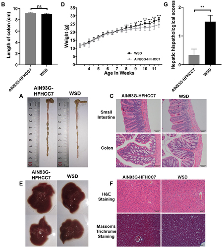 Figure 2 WSD had little effect on intestine before colitis induction.