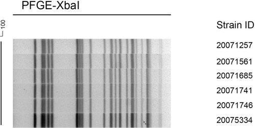 Figure 2 Dendrogram of XbaI-digested genomic DNA from identified KPC-producing Klebsiella pneumoniae.