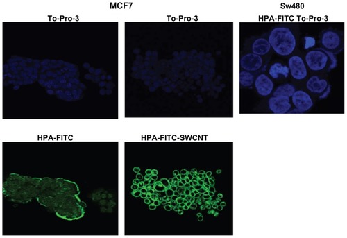 Figure 5 Confocal microscopy of MCF-7 breast cancer cells incubated with HPA-FITC and HPA-lectin-FITC linked to SWCNTs. Lectin binding to MCF-7 and SW480 cells as viewed using a Leica TCS SP2 confocal microscope. Cells were incubated with FITC-labeled HPA (green) and lectin-SWCNTs (green), and the nuclei were counterstained with To-Pro®3 (blue). MCF-7 were observed to interact with the HPA lectin either linked to FITC or to SWCNT; in contrast, the SW480 cells did not bind the lectin.Abbreviations: FITC, fluorescein isothiocyanate; HPA, Helix pomatia agglutinin; SWCNT, single-walled carbon nanotube.