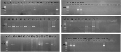 Figure 1. 1.5% Agarose gel showing PCR amplification of OsRuvB gene using gene specific primers (Lanes: M: 1 kb DNA ladder (Fermentas); −ve: negative control; 1–70: T0 plant samples; +ve: positive control). Full length gels are displayed in supplementary figure 1. Different gels separated by white spacing in between.