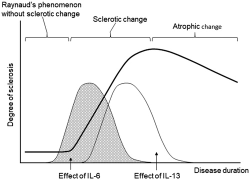 Figure 5. Schematic drawing of the correlation between sclerosis and the effect of IL-6. IL-6 plays a pathological role throughout the disease course in RA. However, pathological factors are substituted during the disease course of SSc.