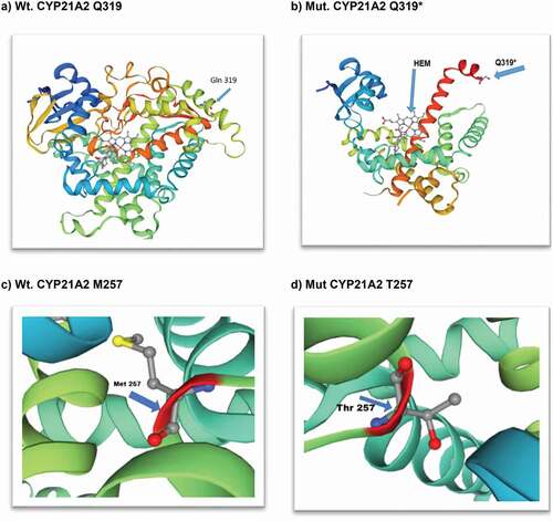 Figure 3. Structural view of human cytochrome P450 21A2 hydroxyprogesterone complex (CYP21A2): X-ray diffraction, 3.31 monomer 1x HEM (https://swissmodel.expasy.org/interactive); (a) wild-type CYP21A2 (30–485 amino acids); (b) mutant stop codon amino acid at 319 (Glutamine); (c) wild-type amino acid Methionine at position 257; (d) mutant missense amino acid Threonine at position 257.