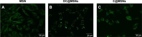 Figure 6 Immunofluorescence staining of β-tubulin in HUVECs after incubations with (A) MSNs, (B) DC@MSNs, and (C) C@MSNs.Abbreviations: C@MSNs, CA4 loaded MSNs; DC@MSNs, DOX and CA4 loaded MSNs; HUVECs, human umbilical vein endothelial cells; MSNs, mesoporous silica nanoparticles.