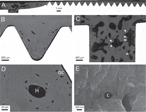 Figure 3. Back-scattered electron micrographs of the bone-implant bloc. A. Overview image of one side of the implant. B. A thread filled with compact bone, which contains several voids suggestive of vascular channels. C. Transversal hole with more porous bone, showing active remodeling with jagged areas (arrowheads) and newly, less mineralized osteoid (*). D. Haversian system (H) and osteocyte lacunae (oc), some of which are located close to the implant surface. E. At higher magnification close to the implant surface, showing canaliculi (c).