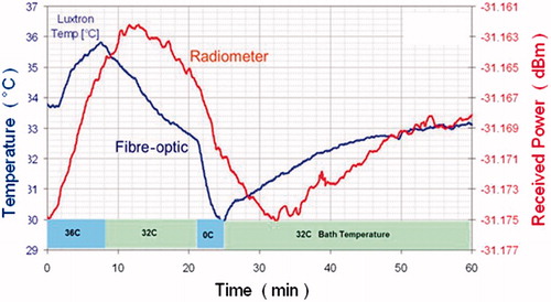 Figure 1. Radiometric versus fibre-optic temperature. Bladder model: fluid is circulated from a temperature-controlled bath to a 30-mL Foley balloon located at 3.5 cm depth. The radiometer measures the ‘average’ bladder temperature, potentially missing extreme temperatures, whereas the fibre-optic probe measures at just a single point. Note the circa 5 min delay in the volumetric data from the radiometer versus the invasive fibre, located at the beginning of the bladder.