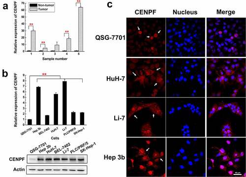 Figure 1. Expression and localization of CENPF in HCC cells and tissues. (a) qRT-PCR analysis of CENPF mRNA levels in five representative tumor and adjacent non-tumor tissue samples from HCC patients. Levels were normalized to GAPDH mRNA. (b) qRT-PCR (upper) and Western blot (lower) analysis of CENPF mRNA and protein expression, respectively, in the normal hepatic cell line QSG-7701 and six HCC cell lines. β-Actin was probed as a loading control. (c) Confocal fluorescence micrographs of CENPF localization (white arrows) in QSG-7701 and HCC cell lines. Red represents CENPF and blue represents nucleus revealed with DAPI (blue). **, p < .01