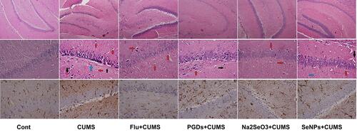 Figure 9 Protective impacts of prodigiosin (PDGs), sodium selenite (Na2SeO3), and prodigiosin-loaded selenium nanoparticles (PDGs-SeNPS) administered orally to CUMS-exposed rats on hippocampal histological alterations and glial fibrillary acidic protein (GFAP) expression. Black arrow: blood vessels congestion; red arrow: apoptotic neurons; blue arrow: neuron edema and degeneration.