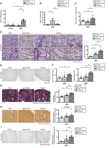 Figure 5. FGF21 deficiency accelerates kidney aging in autophagy-deficient mice. (A) mRNA expression levels of Fgf21 using the isolated PTECs of aged CTRL and atg5F/F-TSKO mice (n = 5 to 8). (B, C and F) mRNA expression levels of Fgf21 (B), Havcr1/Kim-1 (C), and Col1a1 and Tgfβ (F) using whole kidney lysates of aged CTRL, atg5F/F-TSKO, and TSDKO mice (n = 5 to 6). Data were normalized with Gapdh mRNA and presented as the ratio relative to aged CTRL kidney. (D, E, and G to I) Representative images of PAS staining (D), immunostaining for COL1A1 (E), Masson trichrome staining (G), Sirius red staining (H) and immunostaining of ADGRE1/F4/80 (I) in the kidney cortical regions of aged CTRL, atg5F/F-TSKO, and TSDKO mice (n = 6–8). (D) Magnified images from aged CTRL, atg5F/F-TSKO and TSDKO mice indicate brush border loss as well as disruption of lumen structure in the PTECs of TSDKO mice. Arrows indicate cast formation. The tubular injury score (D right), the interstitial fibrotic area (G right), Sirius red-positive area (H right) and ADGRE1/F4/80-positive area (I right) were quantified in at least 10 high-power fields (×400), respectively. (E, G and I) kidney sections were counterstained with hematoxylin. Bars: 50 m. Data are provided as means ± SE. Statistically significant differences (*P < 0.05) are indicated.