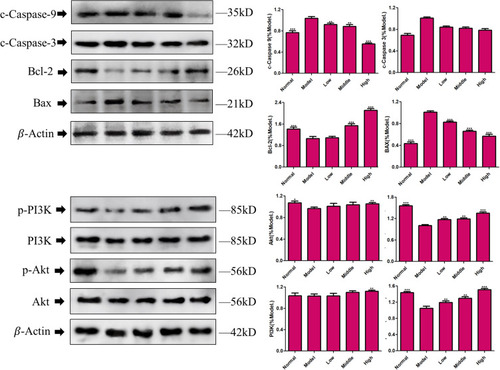 Figure 10 Western blotting. Cells were treated with XYS (0.4, 0.8 or 1.6 mg/mL) for 24 h. Data are the mean ± SD (n = 3). *P<0.05, **P<0.01, ***P<0.001 vs the model group (OGD/R-induced PC12 cells without treatment with XYS).