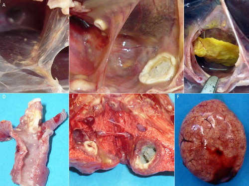 Figure 5. Pathological findings in falcons after experimental infection with Aspergillus fumigatus. (A) + (B) + (C) Fungal granuloma in the air sacs of falcons of varying sizes, from pinhead-sized nodules to complete filling of the air sac. (D) Fungal granuloma at the tracheal bifurcation. (E) Fungal granuloma with active mycelium in the lung. (F) Splenomegaly and follicular hyperplasia.