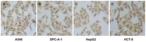 Figure 3 The images of pan-ck protein expression in four kinds of epithelial tumor cells by the ICC method. (A) Lung cancer A549 cells. (B) Lung cancer SPC-A-1 cells. (C) Liver cancer HepG2 cells. (D) Colon cancer HCT-8 cells.Note: The magnification was 100×.Abbreviations: ICC, immunocytochemistry; pan-ck, pan-cytokeratin.