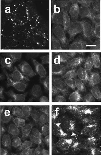 Figure 1. Differential localization of Cx43-HKKSL by a stably transfected clones. HeLa cells stably transfected with either wild type Cx43 (a) or Cx43-HKKSL (b–f) were fixed, permeabilized, and immunolabeled with anti-Cx43. Shown are five different representative HeLa/Cx43-HKKSL clones: 1(Citation1) (b), 1(Citation6) (c), 1(Citation11) (d), 2(Citation2) (e), and 3(Citation3) (f). Most clones had Cx43-HKKSL predominantly localized to the nuclear envelope and reticular structures in the periphery of the cell, reminiscent of the ER (see Figure 2). In contrast, clone 3(Citation3) had a large perinuclear pool of Cx43-HKKSL. 3(Citation3) cells also showed occasional Cx43 labeling at cell-cell interfaces (arrowheads). Bar, 10 μ m.
