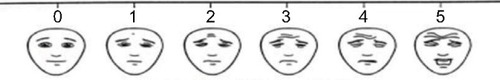 Figure 1 Faces pain scale-revised.