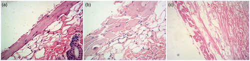 Figure 8. Histopathology photomicrographs (400×) of untreated skin (a), skin treated with RPV propylene glycol solution (b) and RPV-LNCs dispersion (c).