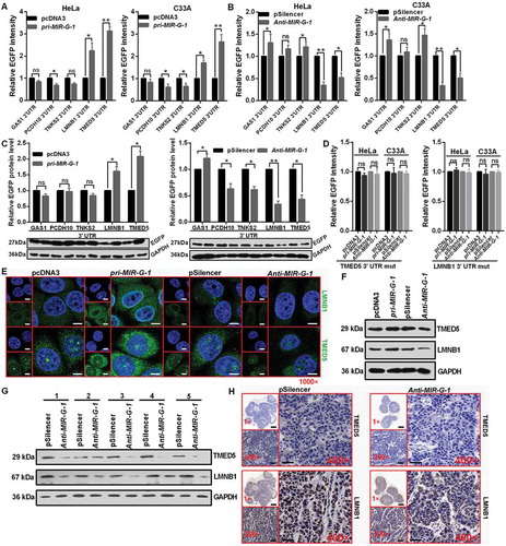 Figure 5. MIR-G-1 targets TMED5 and LMNB1 in cervical cancer. (a) EGFP reporter assay showed cells that were cotransfected with the indicated 3ʹUTR and pri-MIR-G-1 or pcDNA3. (b) EGFP reporter assay showed cells that were cotransfected with the indicated 3ʹUTR and anti-MIR-G-1 or pSilencer. (c) Western blot showed the EGFP protein level for cells transfected with the indicated plasmids. (d) EGFP reporter assay showed cells that were cotransfected with the indicated 3ʹUTR-mut and pri-MIR-G-1 or pcDNA3, anti-MIR-G-1 or pSilencer. (e) IF showed the distribution and expression of TMED5 and LMNB1 in HeLa cells transfected with the indicated plasmids. Scale bar: 20 μm. (f) Western blot assay showed the expression levels of TMED5 and LMNB1 in HeLa cells transfected with the indicated plasmids. (G) Western blot assay showed the expression levels of TMED5 and LMNB1 in subcutaneous xenotransplanted tumor tissues. (h) IHC showed the expression levels of TMED5 and LMNB1 in subcutaneous xenotransplanted tumor tissue. Scale bar: 50 μm. Experiments were performed 3 times, and data are presented as means ± SD.*P < 0.05; **P < 0.01; ***P < 0.001; ns, not significant.