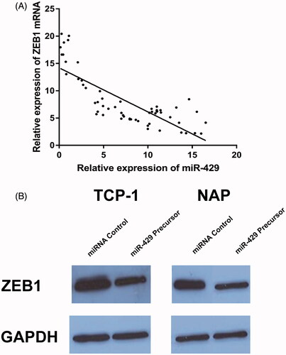 Figure 6. MiR-429 directly regulated ZEB1. (A) The expression of miR-429 is inversely correlated with ZEB1 mRNA. (B) Western blot analysis of ZEB1 expression in the miR-429 and miRNA control groups in TCP-1 and NPA cell lines.