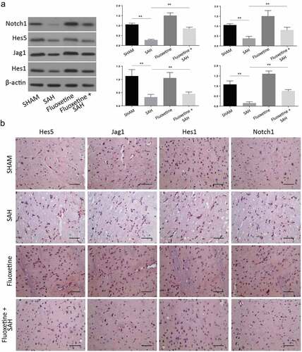 Figure 5. Delivery of Fluoxetine reduces the Notch1 signaling in SAH-induced animal model. A: Western blot analysis exhibiting protein expression of Notch1, Hes1, Jag1 and Hes5, following the treatment with fluoxetine. B: IHC staining of Notch1, Hes1, Jag1 and Hes5 in cerebrum from SAH-induced animal model after Fluoxetine treatment. (n = 6 each group; **p < 0.01).