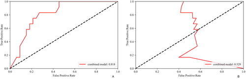 Figure 5. Receiver operating characteristic (ROC) and precision-recall curves of the combined model in the independent cohort (A and B).