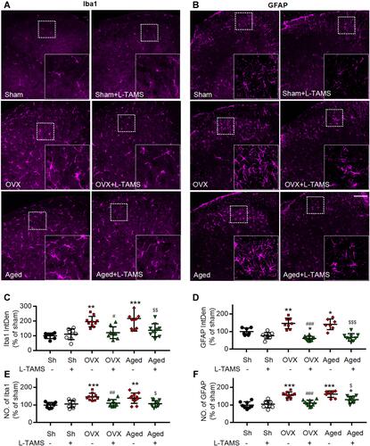 Figure 7 Oral application of L-TAMS inhibits the activation of microglia and astrocytes in spinal dorsal horn in OVX and aged mice. (A and B) Representative confocal images of the immunofluorescence staining of Iba1 (A) and GFAP (B) in spinal dorsal horn of different groups. Scale bar: 100 μm. (C and D) Statistical analysis of immunofluorescence intensity of Iba1 (C) and GFAP (D) in different groups (n = 3–4 mice/group, 2–3 sections/mouse). (E and F) The count of Iba1+ cell (E) and GFAP+ cell (F) in each 20× field were statistically analyzed (n = 3–4 mice/group, 2–3 sections/mouse). The data were analyzed by one-way ANOVA with Tukey’s test. *P<0.05, **P<0.01, ***P<0.001, vs Sham (Sh); #P<0.05, ##P<0.01, ###P<0.001, vs OVX; $P<0.05, $$P<0.01, $$$P<0.001, vs Aged.