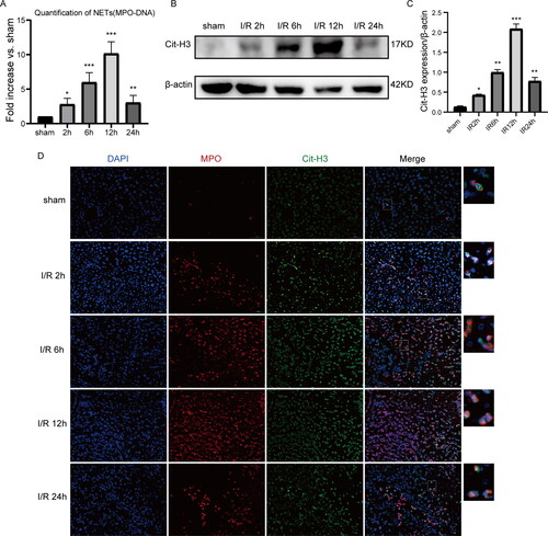 Figure 2. Neutrophil extracellular traps are formed in vivo after liver IRI. (A) According to the evaluation of serum MPO-DNA complex contents, the contents of NETs formed posterior to 1 h ischemic treatment followed by 2 h, 6 h, 12 h, and 24 h of reperfusion. Outcomes are displayed as the comparative fold elevation of MPO-DNA complexes versus sham; average ± SD (n = 6). (B and C) Cit-histone H3 protein contents were identified via WB at different reperfusion time points (D) Typical photos of immunofluorescent dyeing of hepatic samples (initial amplification ×400; scale bars, 50 μm). The existence of Cit-H3 (green), MPO (red), and DAPI (blue) is shown. Data are displayed as the average ± SD (n = 3-6). *P < 0.05, **P < 0.01, ***P < 0.001, ****P < 0.0001 vs sham.