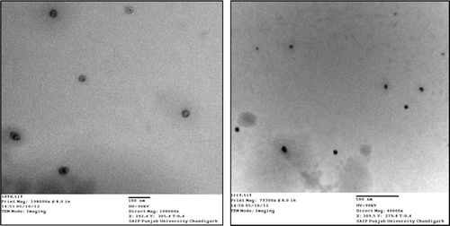Figure 2. TEM images of optimized artemether nanoemulsion.