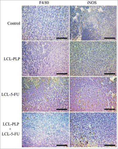 Figure 5. Immunohistochemical analysis of the macrophage antigen F4/80 and iNOS in s.c. C26 colon carcinoma tissue. Positively stained cells appear in brown; size bars = 20 µm. Control - untreated group; LCL-PLP - group treated with 20 mg/kg PLP as liposomal form at days 8 and 11 after tumor cell inoculation; LCL-5-FU - group treated with 1.2 mg/kg 5-FU as liposomal form at days 8 and 11 after tumor cell inoculation; LCL-PLP+LCL-5-FU - group treated with 20 mg/kg LCL-PLP and 1.2 mg/kg LCL-5-FU at days 8 and 11 after tumor cell inoculation.