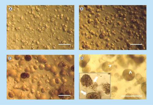 Figure 1.  MCF-12A cell embedded in Matrigel gradually form acini-like structures.Optical microscopy images of MCF-12A. (A) Cells appeared in small clusters after 24 h. They gradually formed acini-like spheroids after 4 days (B), which grow in size after 10 days (C). Fourteen days after being embedded in Matrigel, spheroids preserved their size and some of them were more defined, with clear edges (D; arrowheads), while others were less defined (D; insert, arrows). Scalebars: 250 μm.