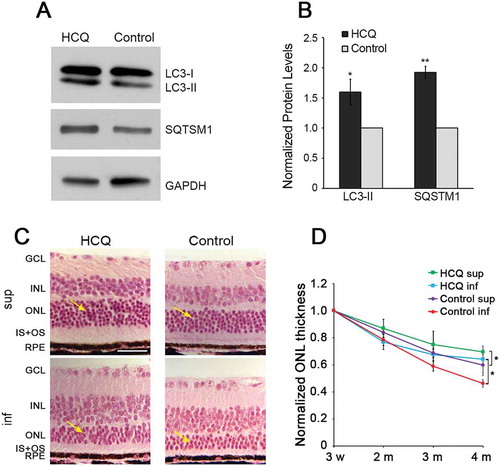 Figure 4. Decreasing autophagy by hydroxychloroquine (HCQ) treatment increased photoreceptor survival in P23H mice. (a) Representative western blots, with quantification of bands (b), probed with LC3 and SQSTM1, normalized to loading control GAPDH in retinas of P23H mice after 3 months of HCQ treatment via drinking water, with untreated P23H controls set as 1. (c) Hematoxylin and eosin (H&E) stained images of superior (sup) and inferior (inf) retina from 4-month-old HCQ-treated P23H and control mice. Retinal cell layers labeled as in Figure 3. Yellow arrows point to the ONL, where the photoreceptor nuclei reside. Scale bar: 50 µm. (d) Line graph showing the ONL thickness of superior and inferior area of the retinas, as measured by OCT at 500 µm from the optic nerve head, in the HCQ-treated P23H and control group (n = 4–16). Data presented as mean ± SD, *, p < 0.05, **, p < 0.01, unpaired t-test.