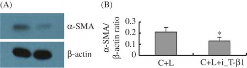Figure 3.  Inhibition of TGF-β1 inhibits α-SMA expression in glomerulus mesangial cells stimulated by LPS. (A) Representative Western blot analysis of α-SMA protein level 48 h after addition of TGF-β1 inhibitor. (B) Densitometric analysis of α-SMA protein normalized to β-actin. C + L, cells + LPS; C + L + i-T-β1, cells + LPS + inhibition of TGF-β1 (8 μg). *p < 0.05 versus C + L group.