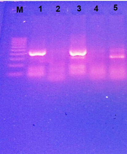 Figure 2 Detection of UPEC PAIs using multiplex PCR A to detect PAI III536 (200 bp), PAI IV536 (300 bp) and PAI IICFT073 (400 bp). Lane M: 100 pb DNA ladder. Lane 1: UPEC strains with PAI IICFT073, Lane 2: UPEC strains with no PAI, Lane 3: UPEC strains with PAI IV536 and PAI IICFT073, Lane 4: UPEC strains with no PAI and Lane 5: UPEC strains with PAI IV536.