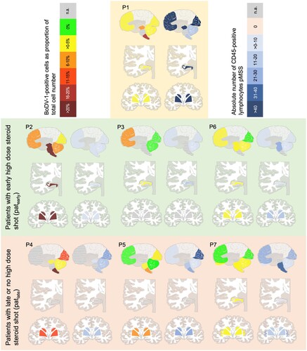 Figure 3. Distribution of BoDV-1-positive cells and lymphocytes. Demonstrated is the amount of BoDV-1-positive cells (left) and absolute number of CD45-positive lymphocytes pMSS (right) for all seven patients. Shaded in yellow is P1 as exeption regarding the setting of infection. Below, patearly are shaded in green, followed by patlate, shaded in red.